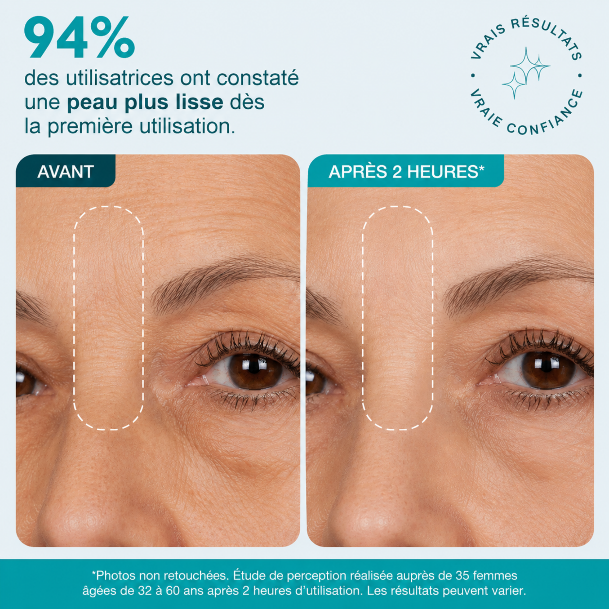 Patch Skinjection aux peptides — Visage & Contour des yeux